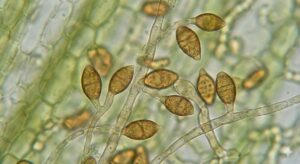 Thuốc trị bệnh rỉ sắt cà phê